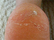 before-5.jpg